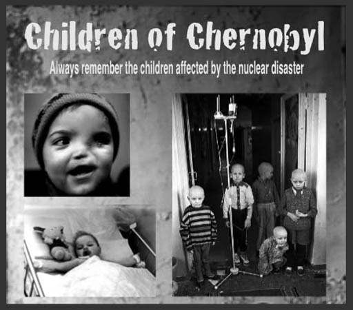 Chernobyl_Children_520